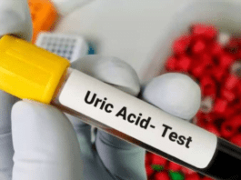 Uric acid