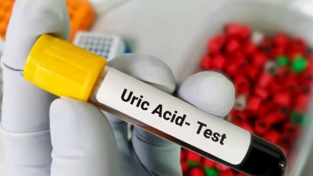 Uric acid