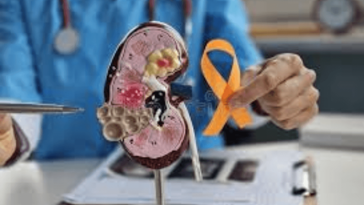 Kidney cancer