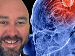 Brain cancer