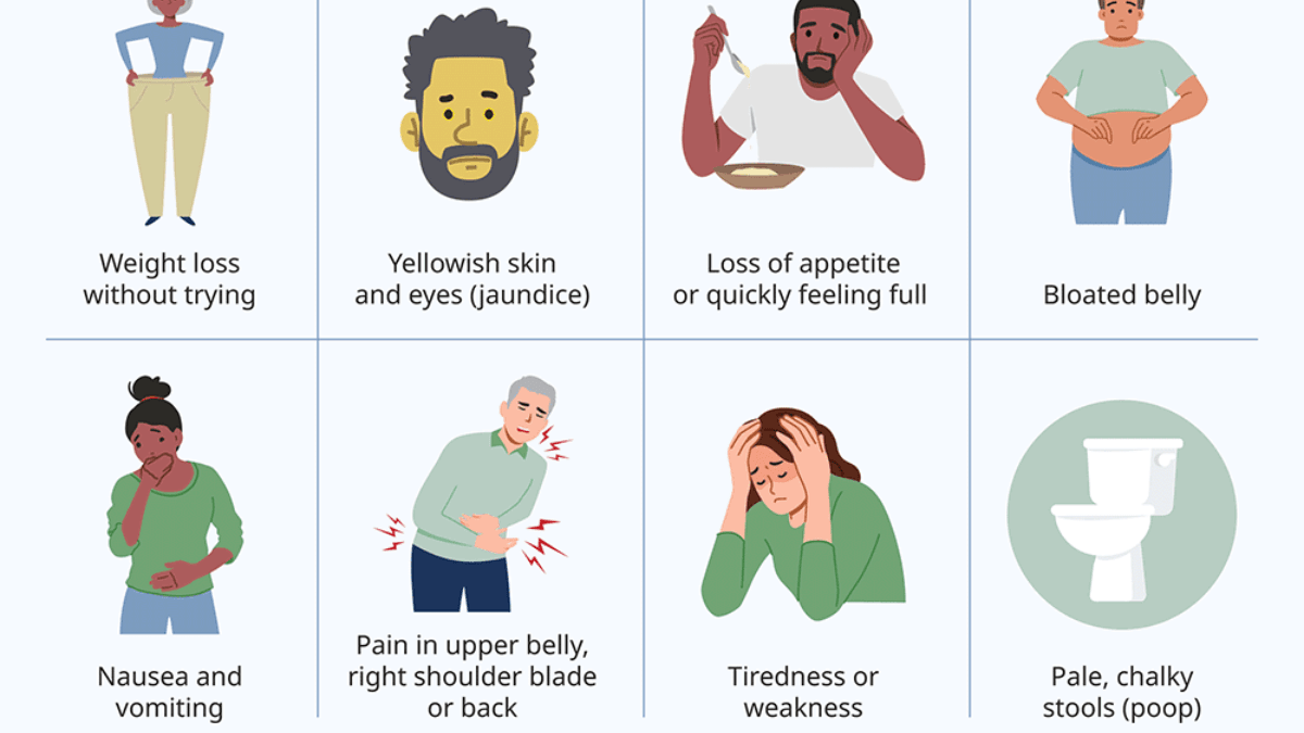 Alarming signs of renal cell carcinoma