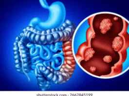 deadly-disease-silently-spreads