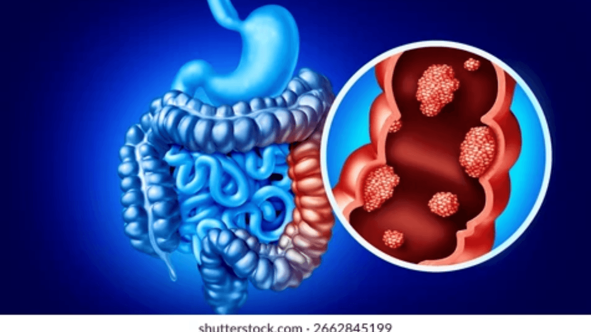 deadly-disease-silently-spreads