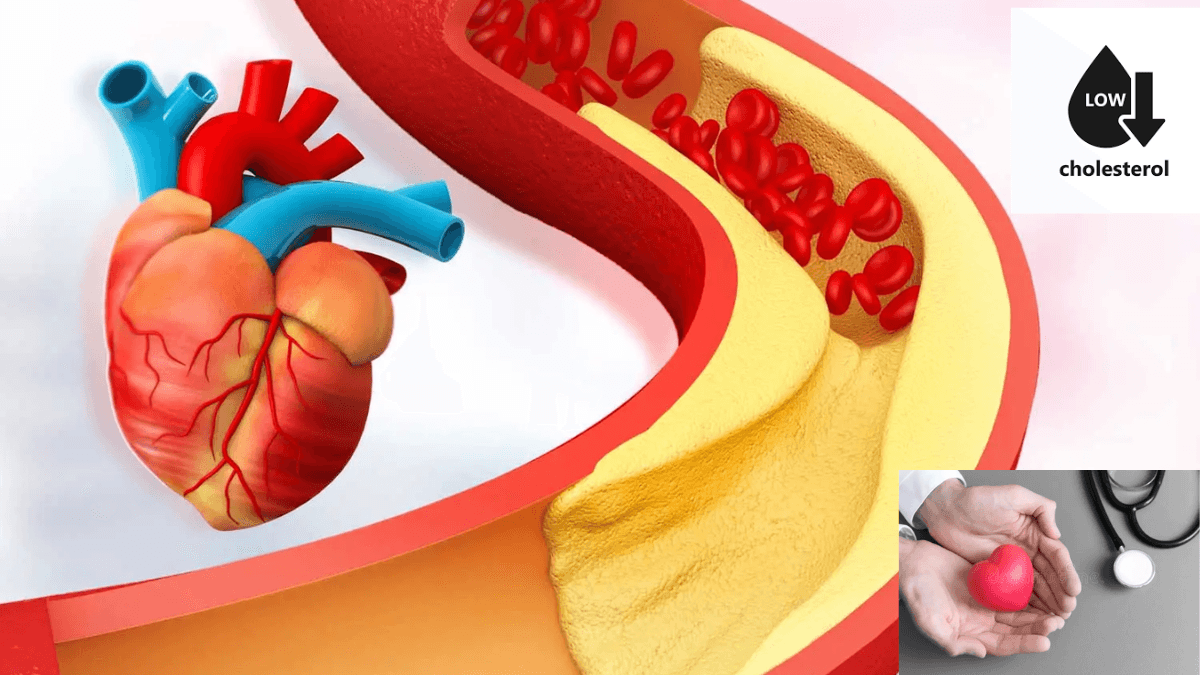 Does low cholesterol prevent heart attacks?