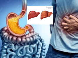Heartburn and cure fatty liver