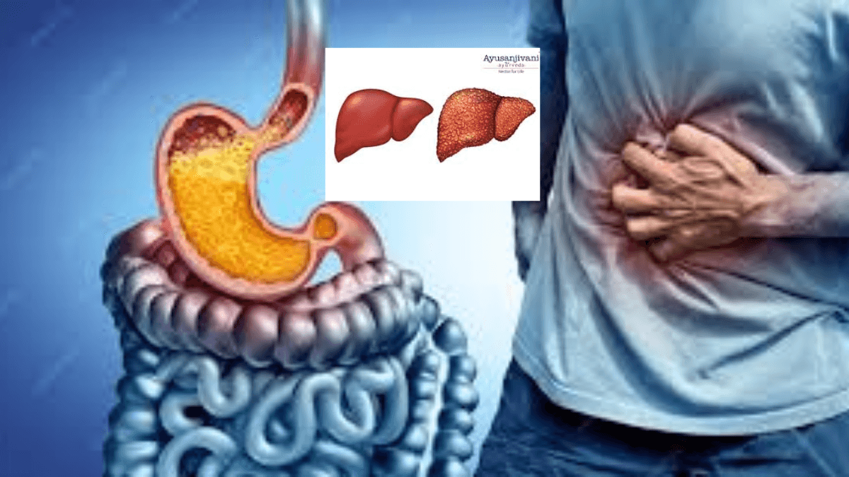 Heartburn and cure fatty liver