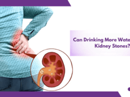How much water to drink to avoid kidney stones? Hydration for prevention of kidney stones