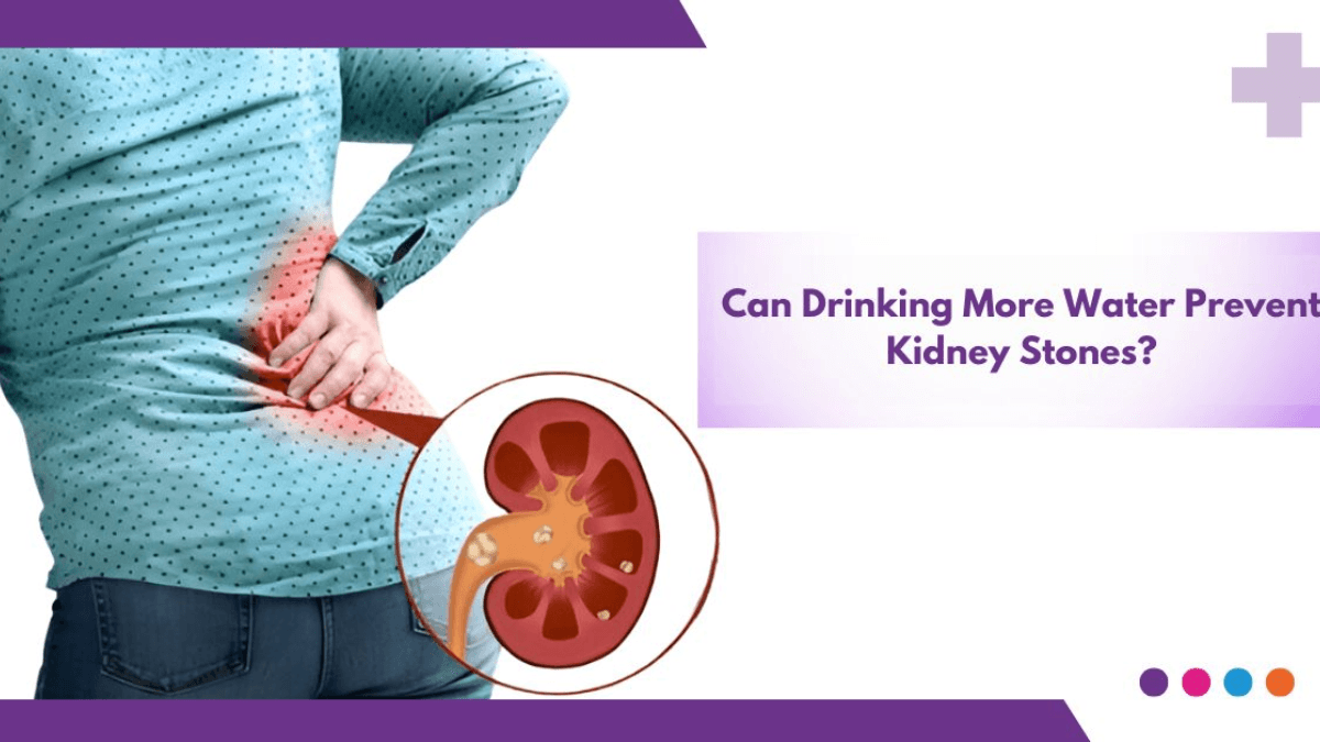 Hydration for prevention of kidney stones